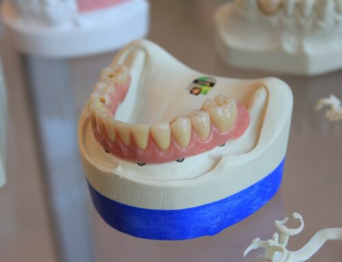 Kekurangan & Kelebihan Gigi Palsu Lepasan Wajib Kamu Ketahui